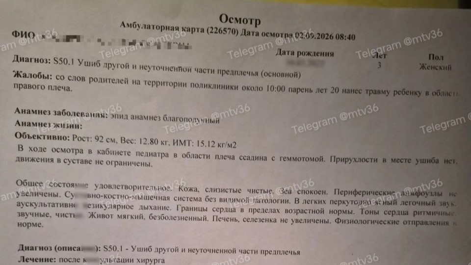 Трое малышей пострадали после нападений мужчины в Воронеже
